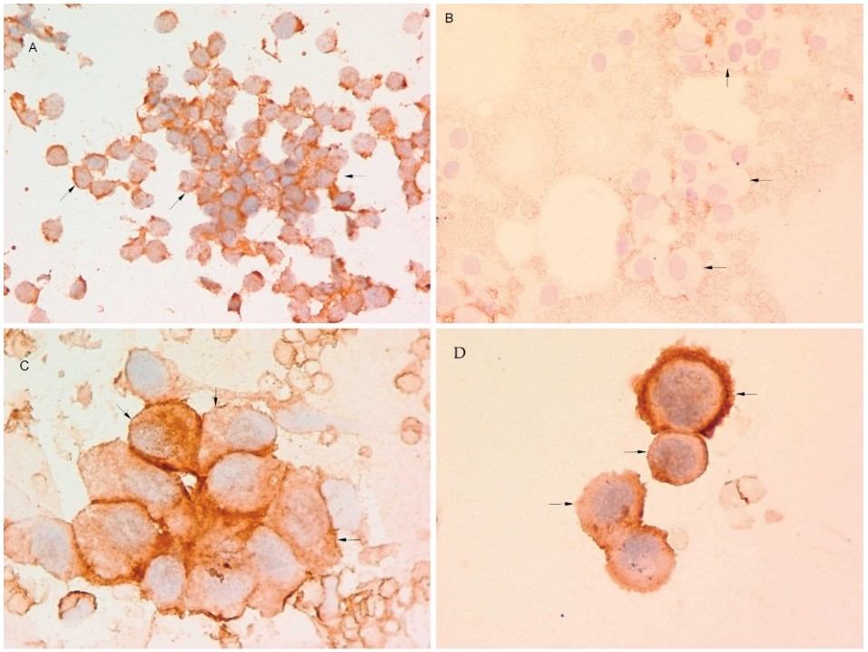 RANKL expression in dog samples. (Barger, et al., 2007) (OA Literature)