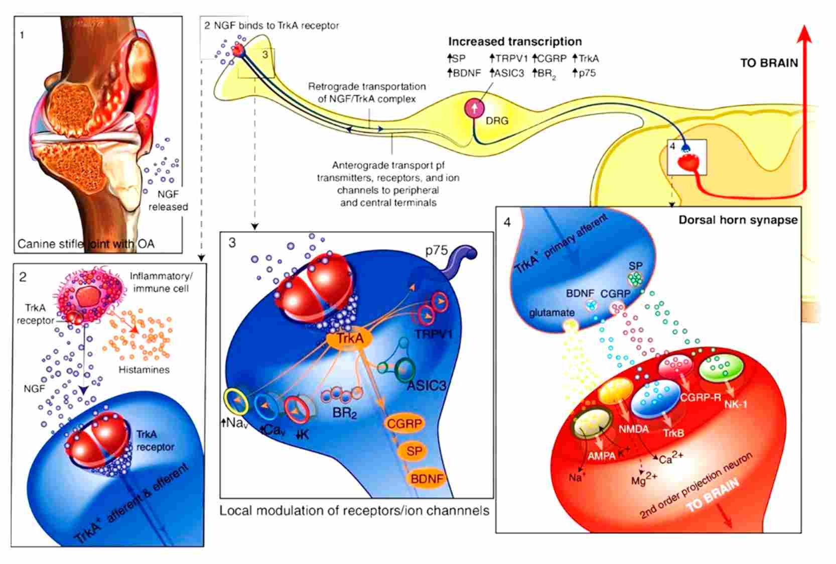 NGF Role in Osteoarthritis. (Wang et al., 2025) (OA Literature)