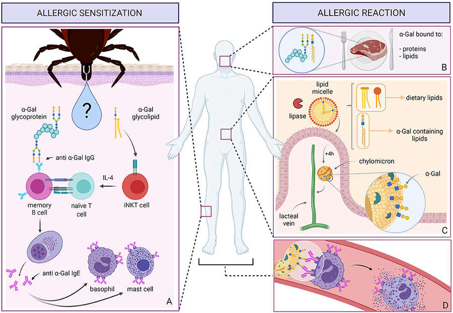 Fig.2 Schematic of allergic sensitization to α-Gal. (OA Literature)