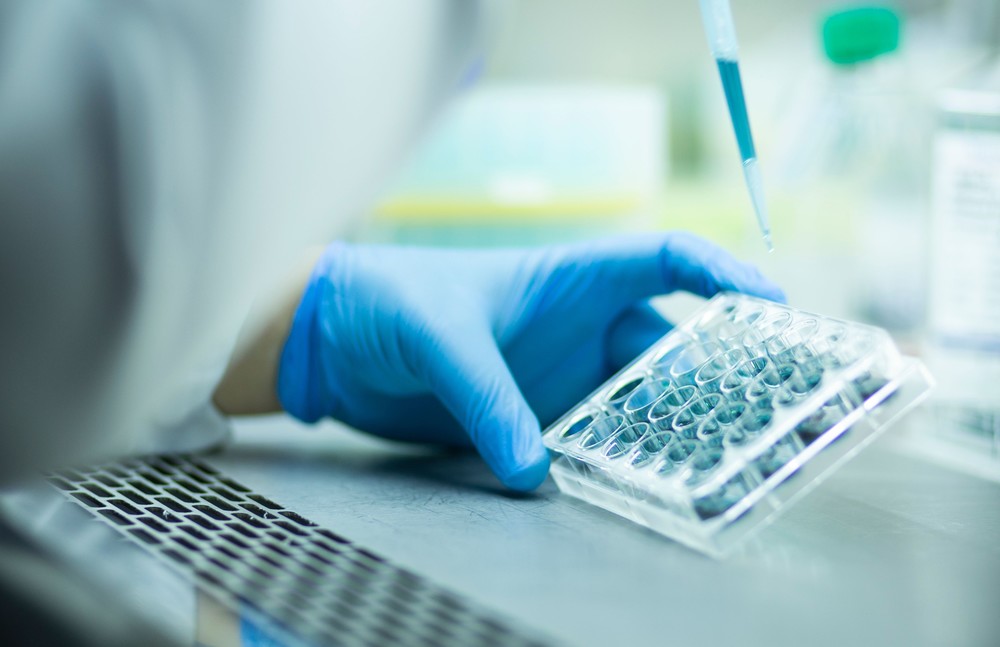 Sample submission guidance for serum anti-glycan antibody profiling