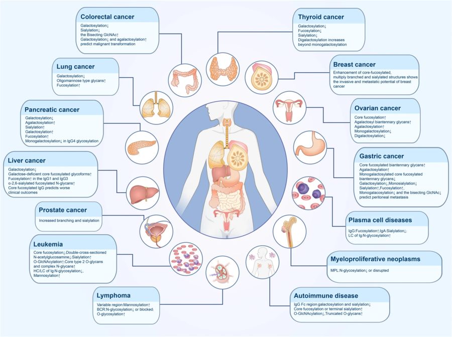 Altered glycosylation found in human disease. (OA Literature)