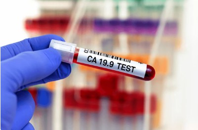 The schematic of CA19-9 test. (Creative Biolabs Authorized) 