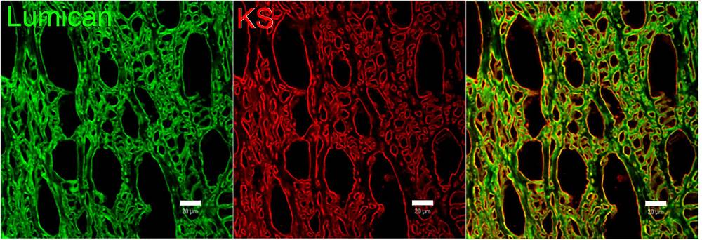 Fig.1 Immunofluorescence showing sulfated keratan sulfate (red) and lumican (green) regulating collagen spacing in human corneal stroma. (OA Literature)