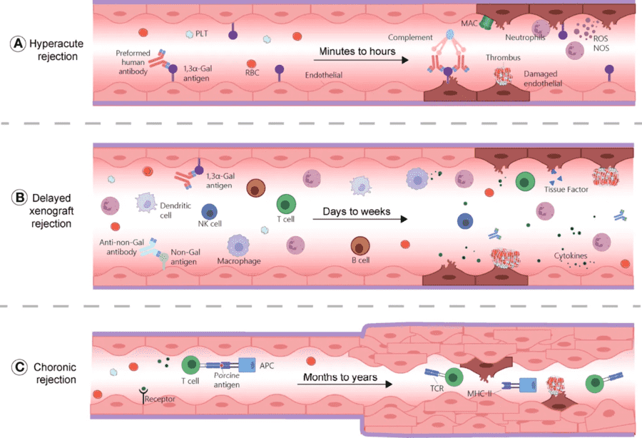 Fig.1 mechanisms of xenotransplantation rejection involving hyperacute rejection delayed xenograft rejection and chronic rejection. (OA Literature)