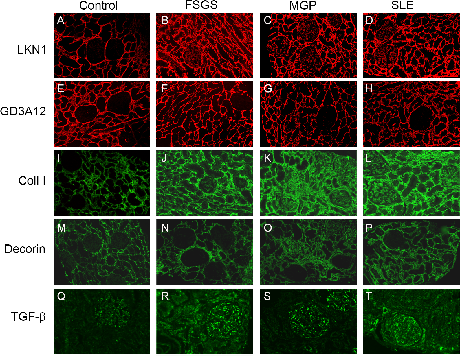 Fig.1 Analysis of Dermatan Sulfate Composition in Fibroblasts. (OA Literature)