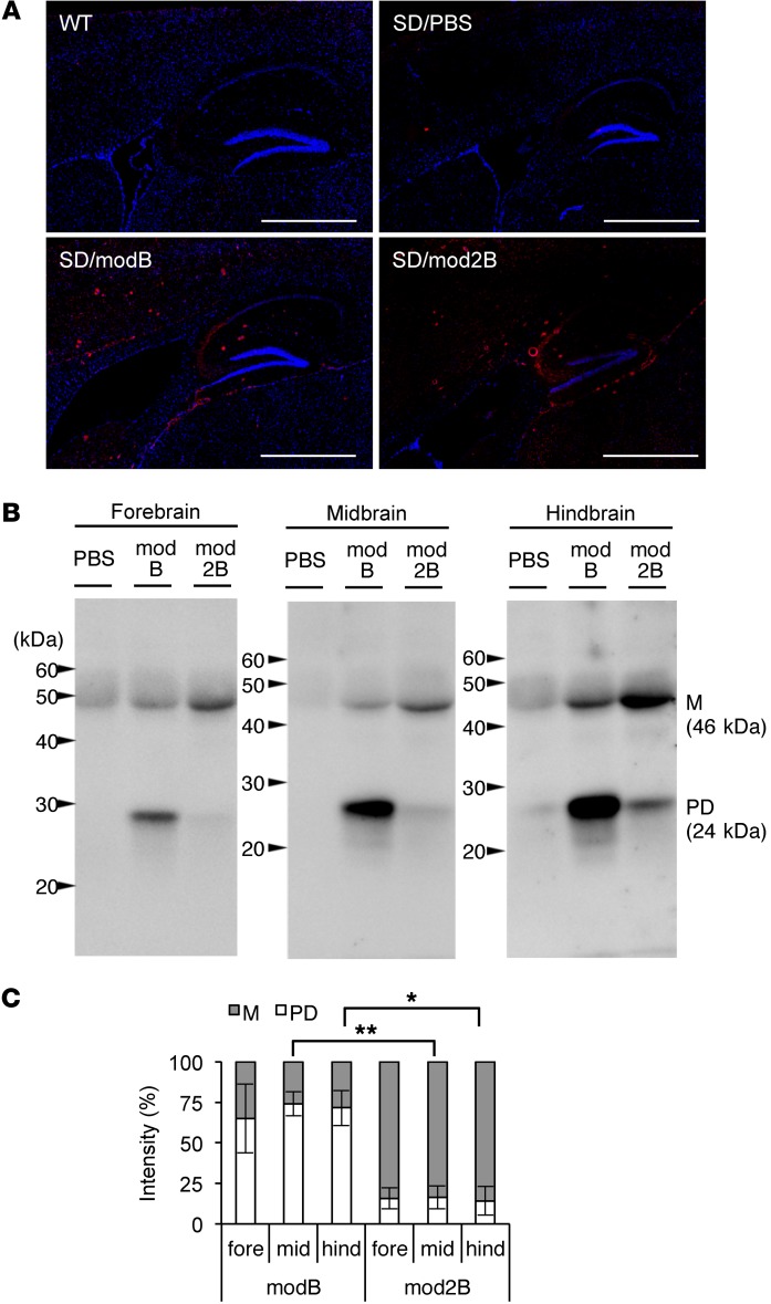 Fig.1 Immunohistochemistry and immunoblotting analysis showing the distribution and structural stability of recombinant hexosaminidase B in the brain of Sandhoff disease mice. (OA Literature)
