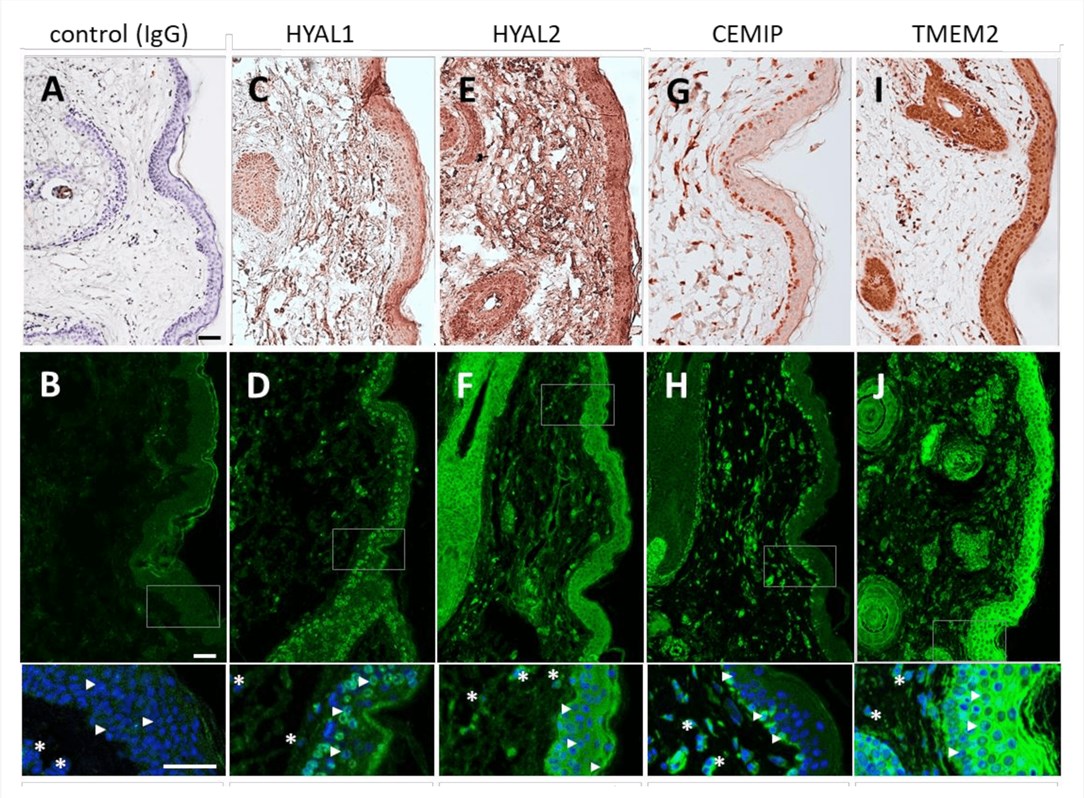 Immunohistochemistry and immunofluorescence staining of human skin showing intracellular distribution of HYAL1, HYAL2, CEMIP, and TMEM2 proteins.