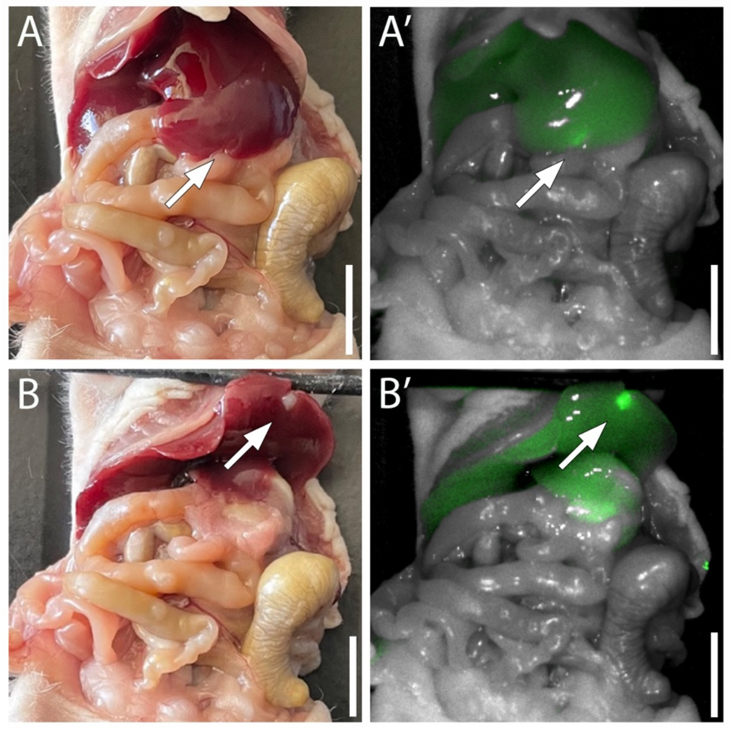 Fig.1 Fluorescence labeling of orthotopic pancreatic cancer liver metastasis by MUC5AC-IR800. (OA Literature)