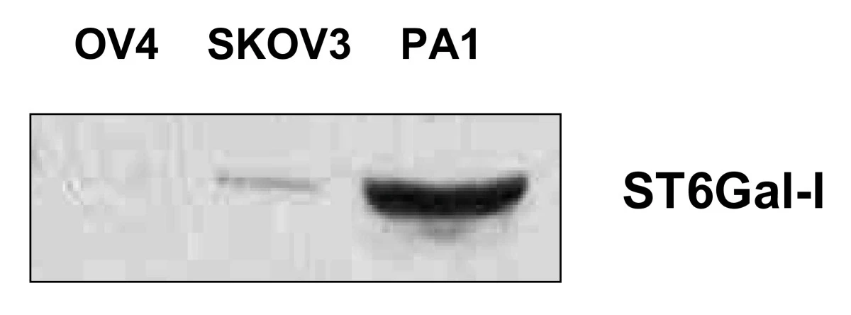 Fig.1 Western blot analysis of ST6Gal-I expression. Lysates from three ovarian carcinoma cell lines (PA1, OV4, and SKOV3) were resolved by SDS-PAGE and immunoblotted, revealing differential levels of endogenous ST6Gal-I protein consistent with their metastatic potential. (OA Literature)