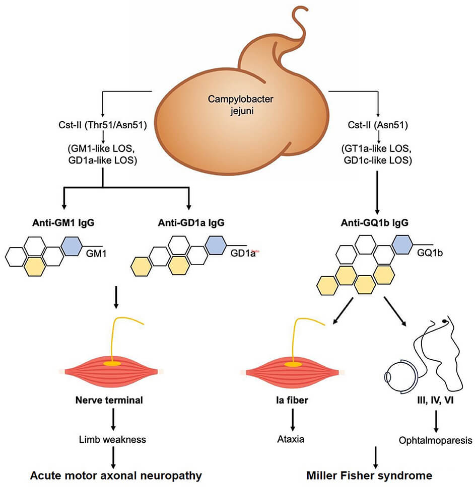 Fig.1 Schematic highlighting miller fisher syndrome: campylobacter jejuni molecular mimicry induces IgG anti-gq1b antibodies that bind gq1b on cranial nerves iii, iv, and vi, leading to ophthalmoplegia and ataxia. (OA Literature)