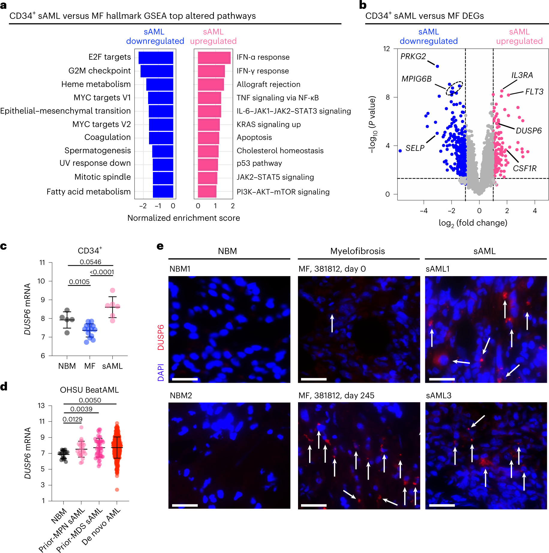 Fig. 1 DUSP6 mediates resistance to JAK2 inhibition and drives leukemic progression. (Kong, 2023)