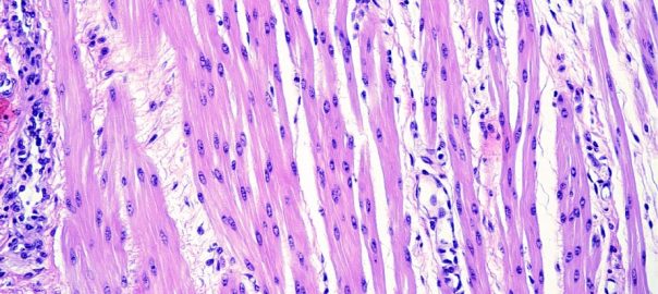 NHP-Smooth-Muscle-Cells