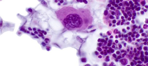 NHP-Bone-marrow-cells