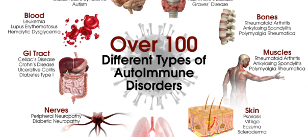 An autoimmune disease is a pathological condition resulting from an abnormal immune response to tissues that can exist in the body,