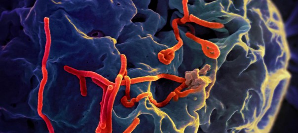 Ebola virus particles (red) on a larger cell. ZMAPP, a potential treatment for Ebola, includes a cocktail of monoclonal antibodies.