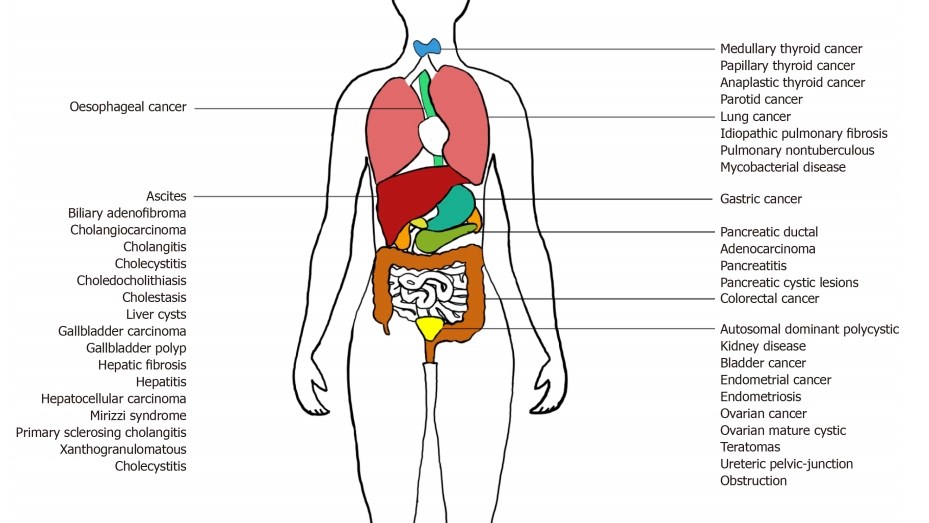 CA 19-9 physiology and pathology involvement. (Lee, et al., 2020)