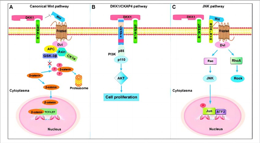 Signaling pathways involving DKK1. (Jiang, et al., 2022) 