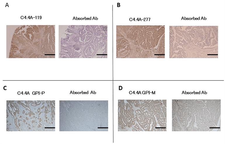 Absorption test on CRC tissues for (A) C4.4A-119 antibody, (B) C4.4A-277 antibody, (C) C4.4A GPI-P antibody, and (D) C4.4A GPI-M antibody (Yamamoto, H., 2013).