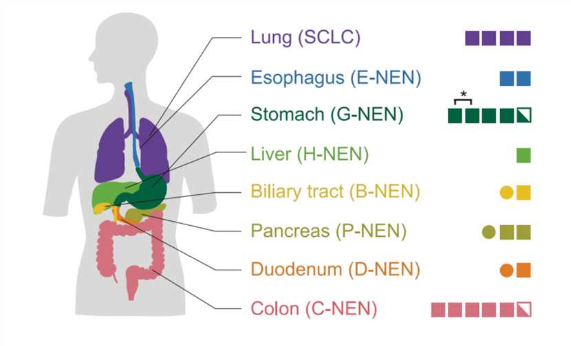Workflow for NEC organoid establishment.