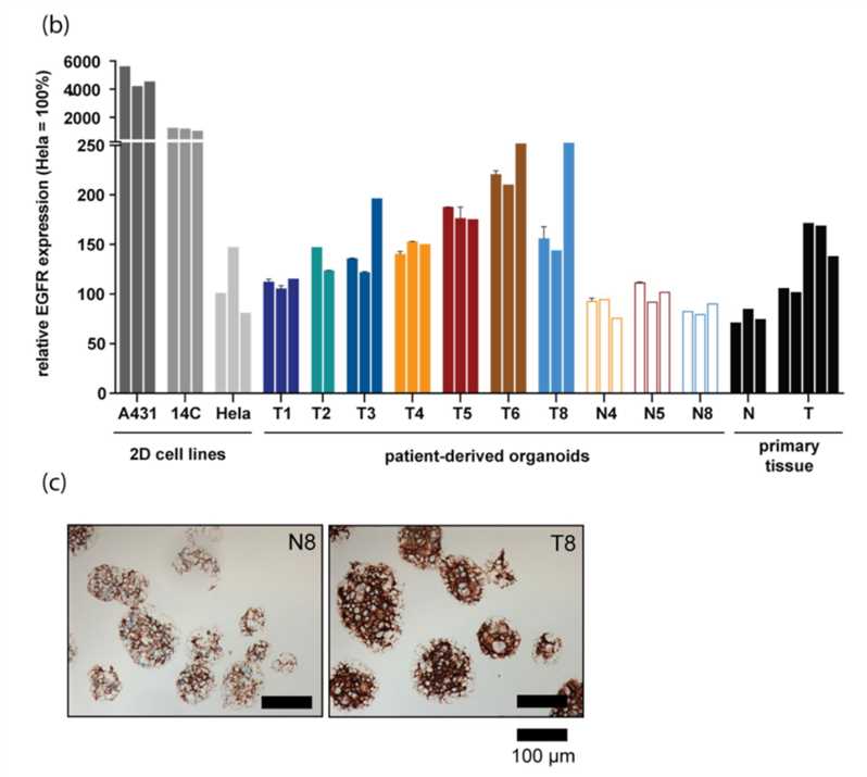 Organoids recapitulate EGFR expression in parental tumor specimen.