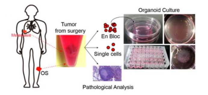 Scheme of the OS organoid production.
