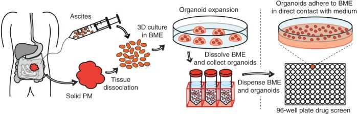 Peritoneal Metastatic Colorectal Cancer Organoid Models