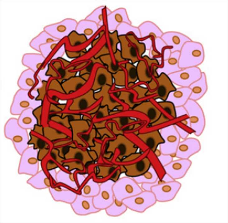 Application of Peritoneal Metastatic Colorectal Cancer Organoids