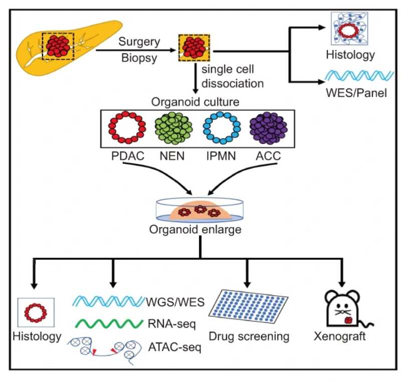 Pancreatic cancer organoid serves as a functional preclinical research model.