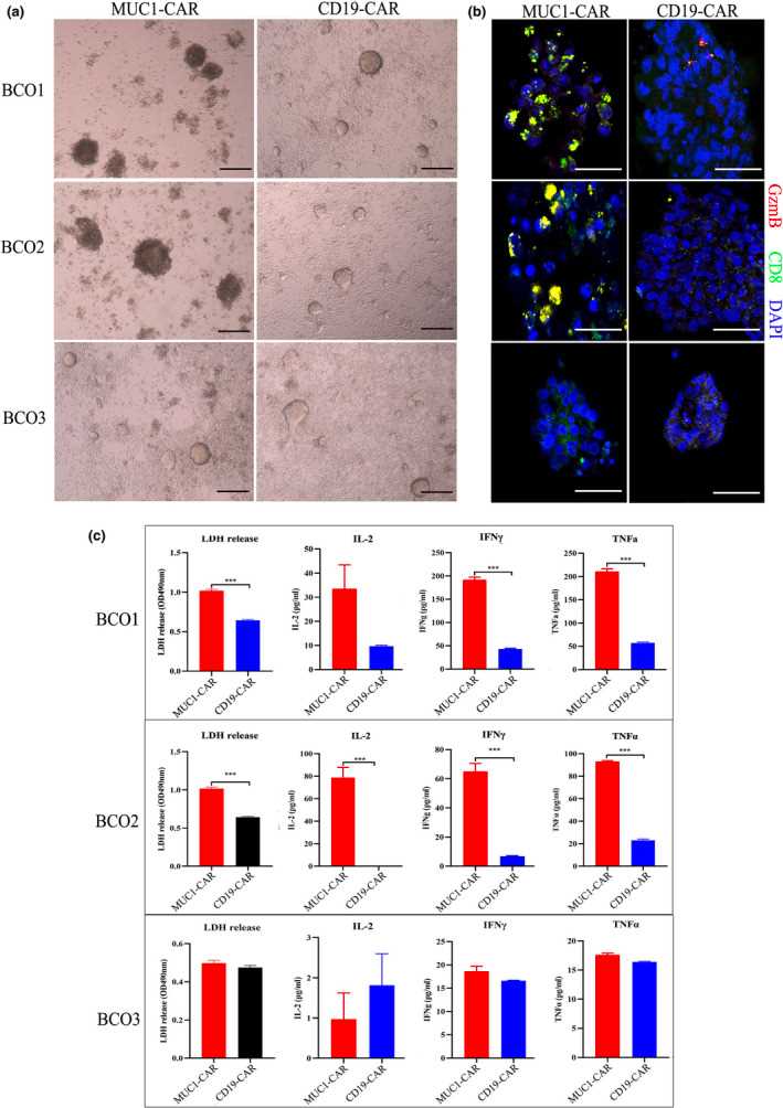 Specific cytotoxicity of CAR-T cell in bladder cancer organoids. 