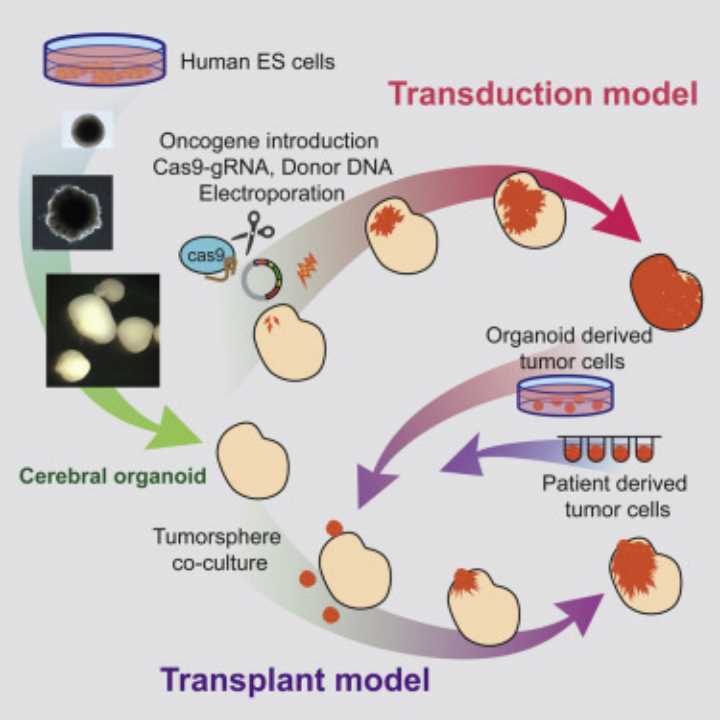 Establish brain cancer organoids from PSC using Nucleofection.