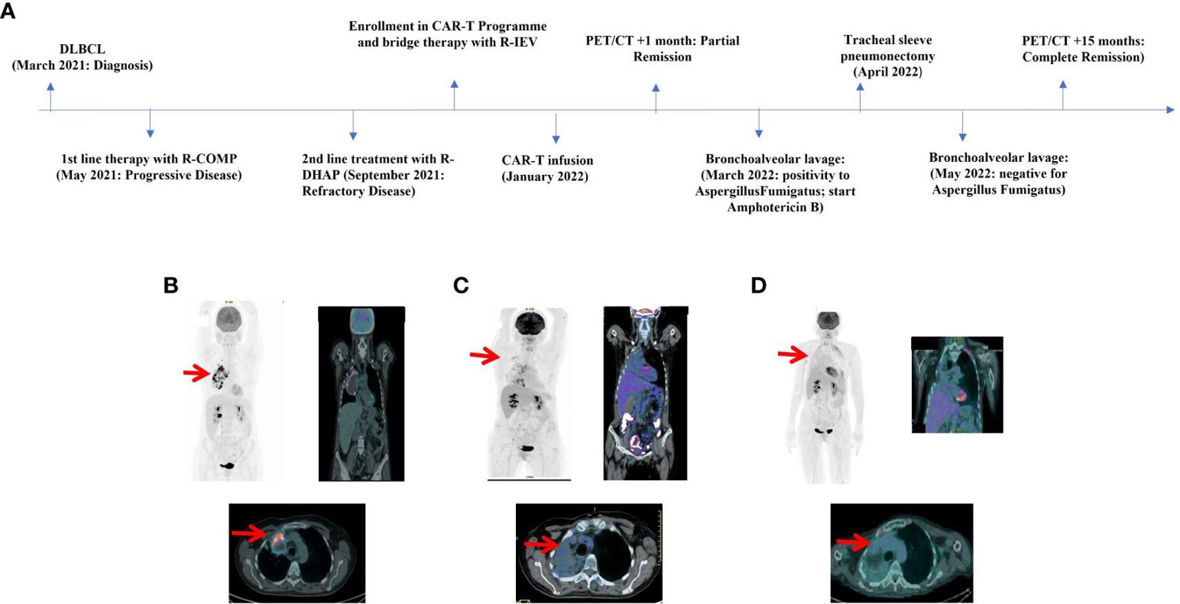 Fig.1 Timeline illustrating the therapies carried out and the outcomes. (OA Literature)