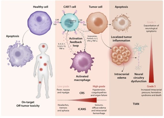 Fig.1 CART toxicities. (OA Literature)