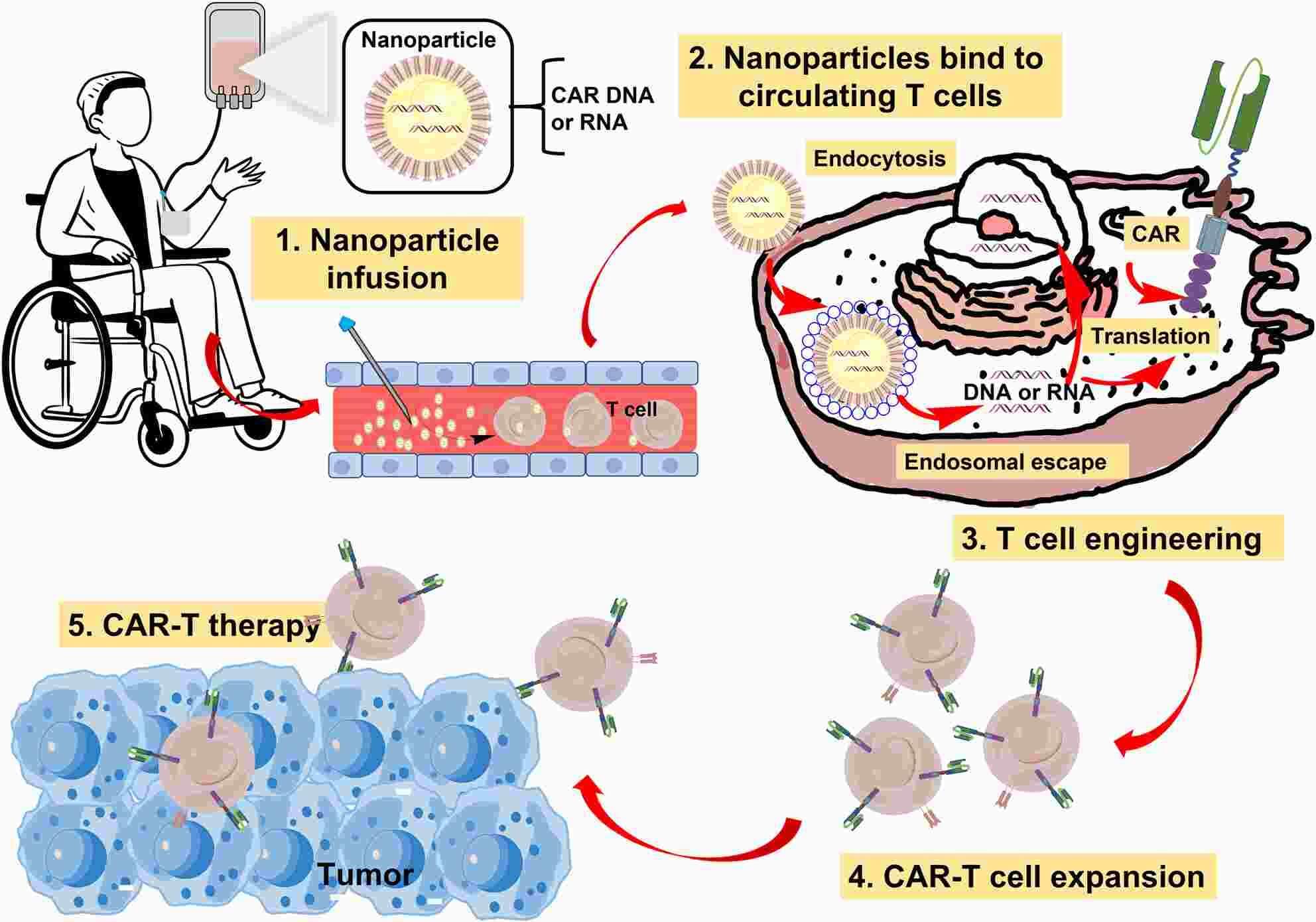 Fig.1 Schematic illustration of the in vivo process of in situ CAR-T cell therapy via nanoparticles. (OA Literature)