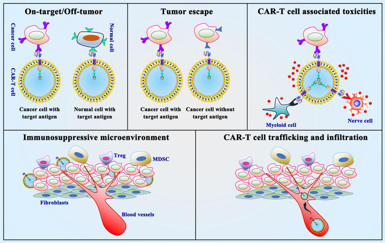 Fig.1 Restrictions and difficulties facing CAR-T cell-based immunotherapy. (OA Literature)