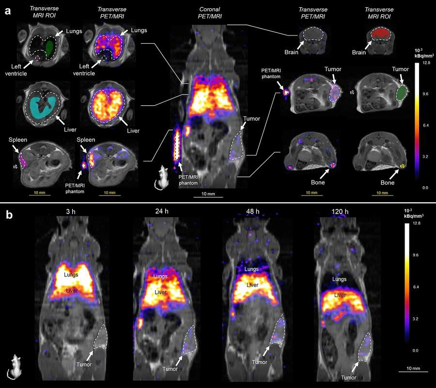 Fig.1 Maging analysis for CAR-T cells in vivo. (OA Literature)