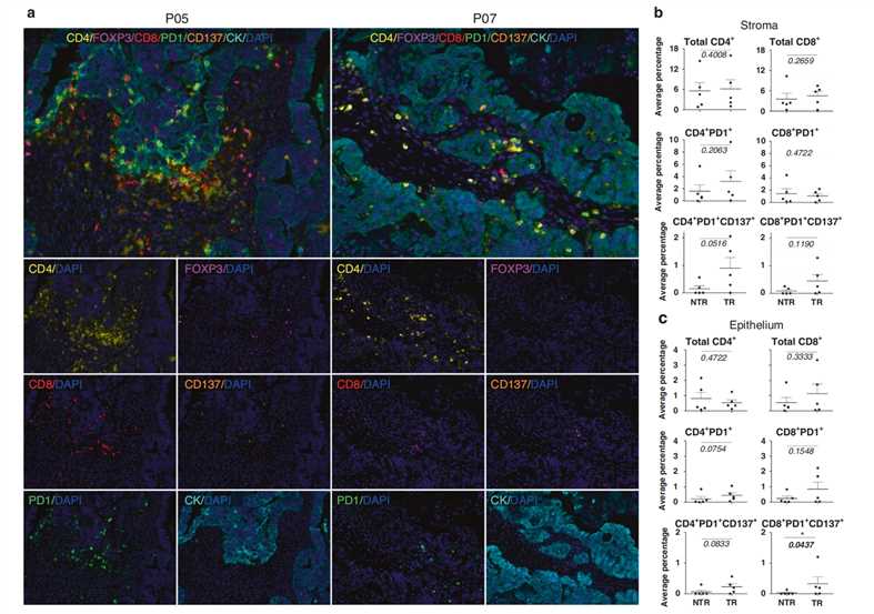 Multiplex Immunofluorescence Assessment of Different TIL Subsets in the Tumour Microenvironment.