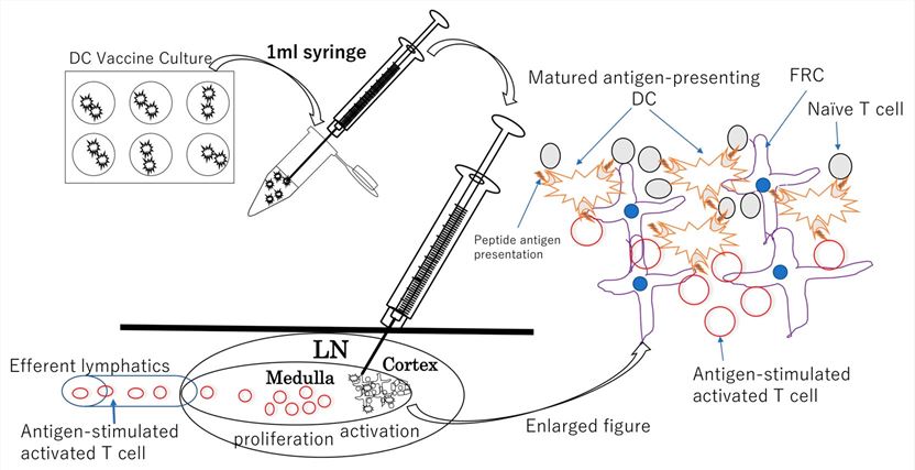 Fig.1 DC vaccine injection schematic representation. (OA Literature)