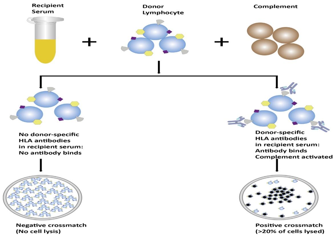 Fig.1 Process of CDC-XM. (Mishra, Dinesh & Vimarsh, 2024)
