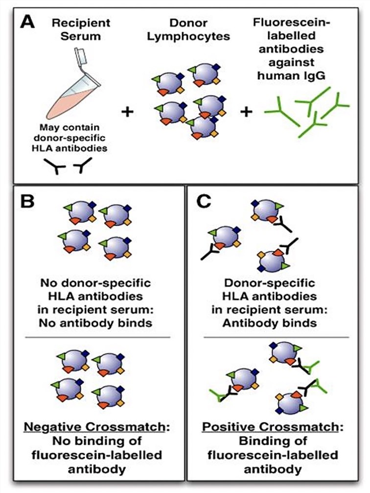 Flow cytometry crossmatch technique.