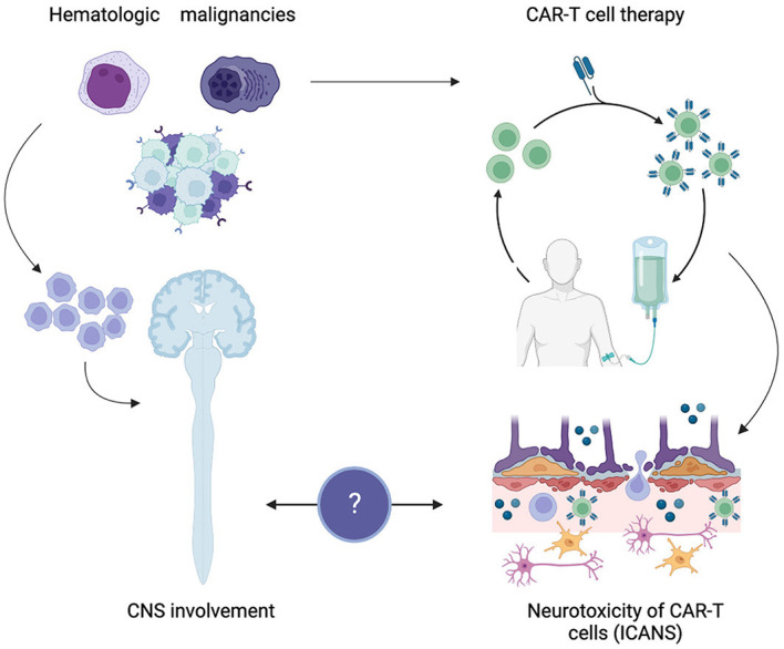 Fig.1 CAR-T cell-induced neurotoxicity in hematologic conditions affecting the central nervous system. (OA Literature)
