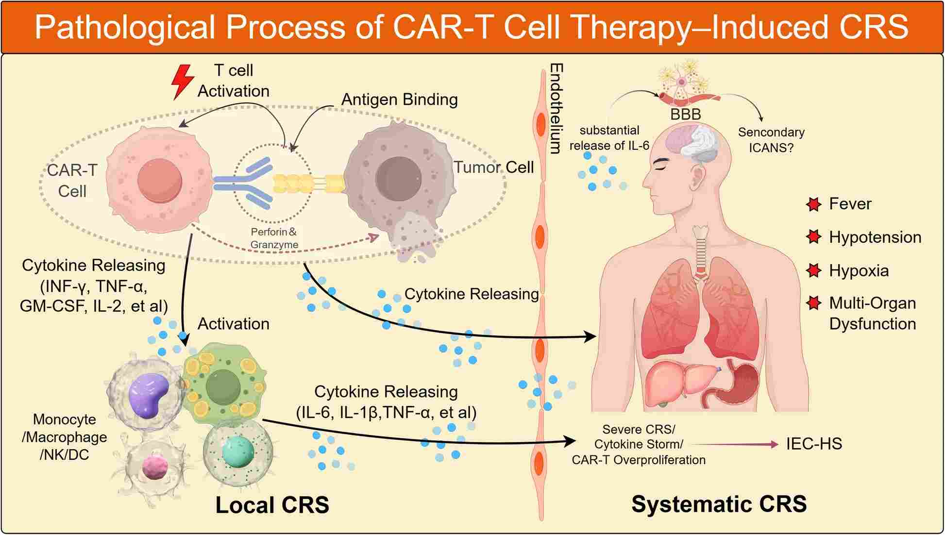 Pathological process of CRS induced by CAR-T cell therapy. (OA Literature)
