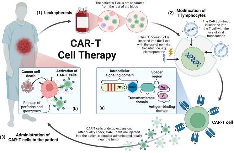 Fig.1 Manufacturing procedures for CAR-T cell therapies. (OA Literature)