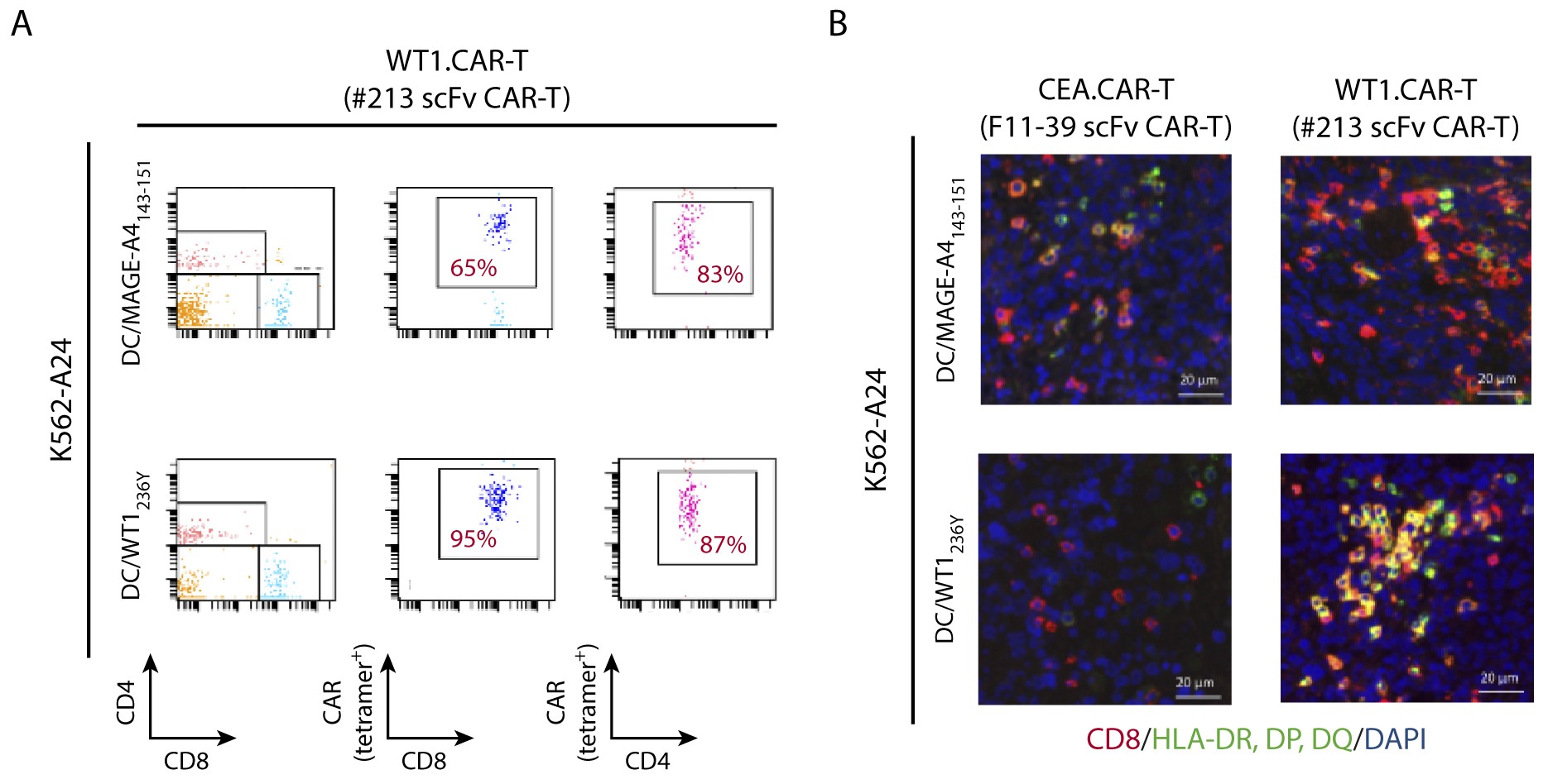 Fig.2 The expansion and activation status of CAR-T cells in peripheral blood (Fig.2A) and tumor tissues (Fig.2B). (Akahori, et al., 2018)