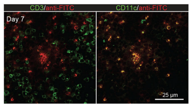 Fig.2 IHC of LNs. (Ma, et al., 2019)