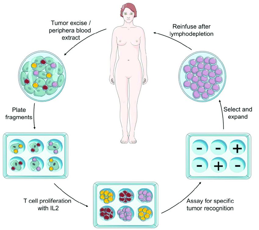 Schematic representation of adoptive cell transfer immunotherapy procedure
