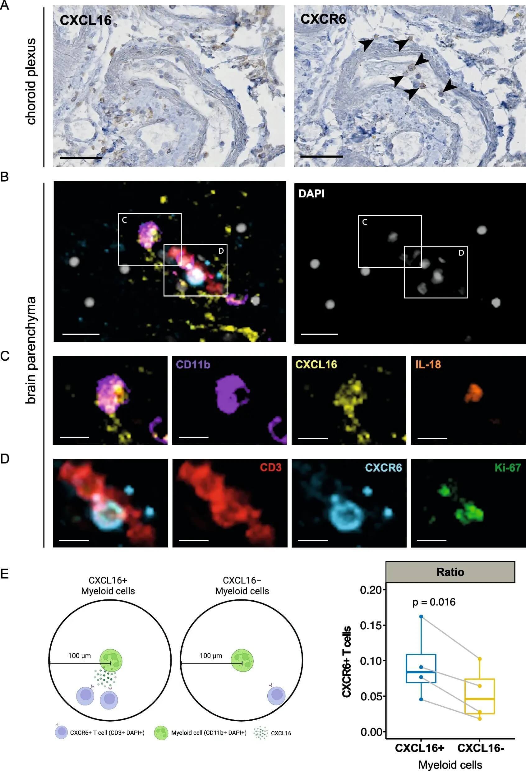 Immunohistochemistry of CXCL16 and CXCR6. (OA Literature)