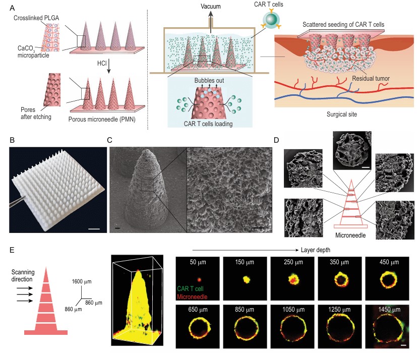 Characterization of porous microneedle (PMN) patches designed for CAR-T cell loading and delivery. (OA Literature)