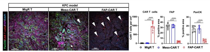 Multiplex IF analysis of FAP-CAR T cells localization in KPC mouse model. (Xiao, et al., 2023)