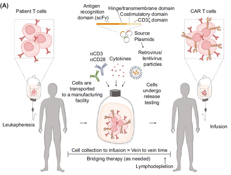 Fig.1 Ex vivo CART manufacture procedure. (Short, Lauralie, et al., 2024)
