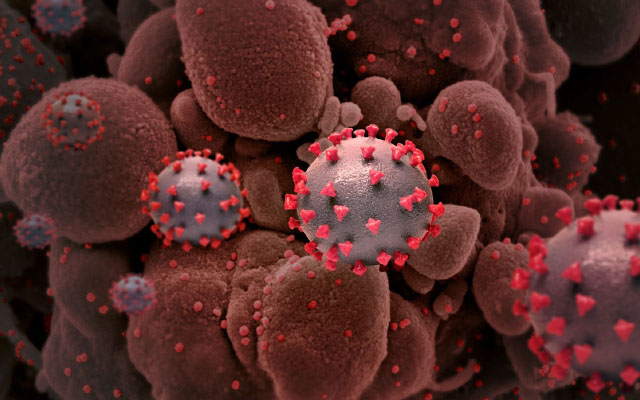 Immune Monitoring Platform (Creative Biolabs Authorized)